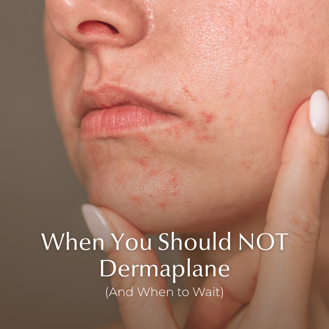 When You Should NOT Dermaplane (And When to Wait)